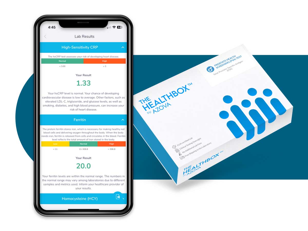 Prostate Health Screening (PSA) Test