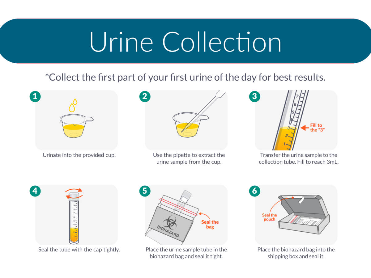 Kidney Health Urine Test