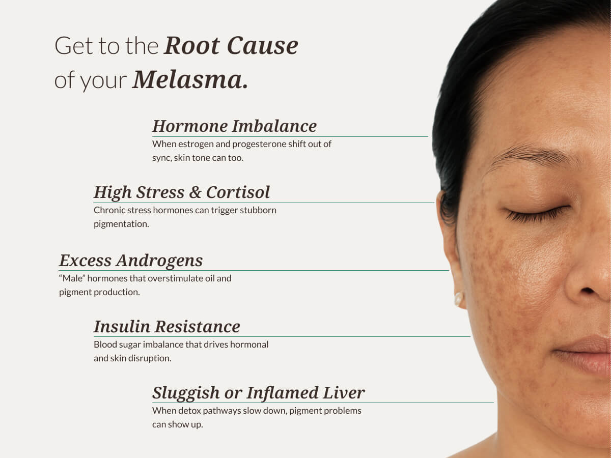 Root Cause Melasma Bundle
