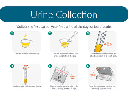 Kidney Health Urine Test